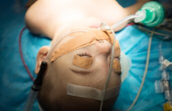 child in heart surgery