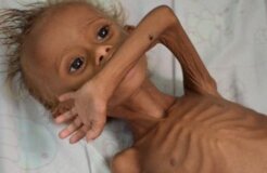 Yemen_Hunger crisis